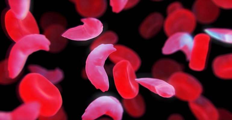 Africa Eye: Sickle Cell: The Enemy Within